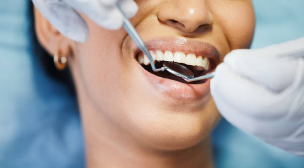 Best Chipped Tooth Repair Near Me  in Guin, AL